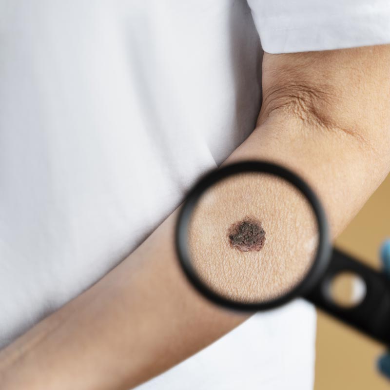 Medical Services - Precancers and Cancers